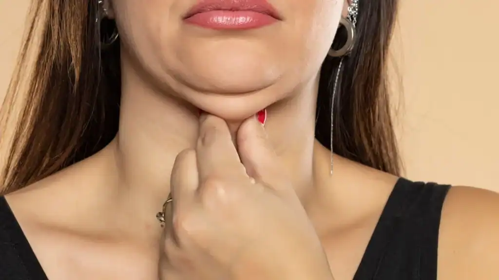 An image of a woman with double chin, sad, worried : Non Surgical Double Chin Removal Treatment in London, UK