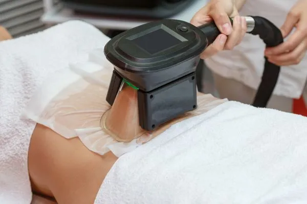 Image of person having fat freezing treatment to help weight gain London