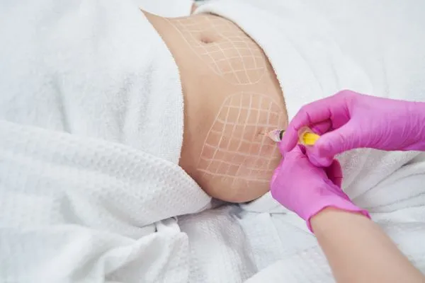 image of fat dissolving injections on love handles to help combat weight gain London