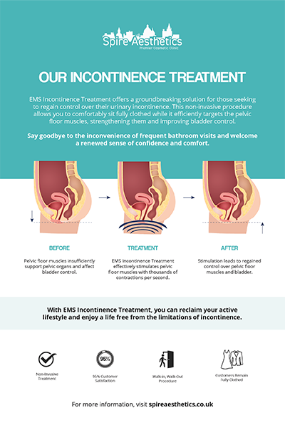 image to show how EMS treatment works for female urinary incontinence London