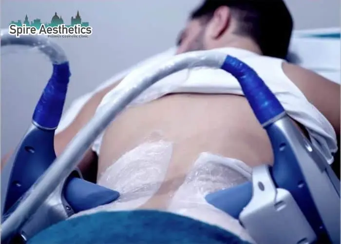 Man having fat freezing treatment done on love handles before a competitions London to create a sculpted look.