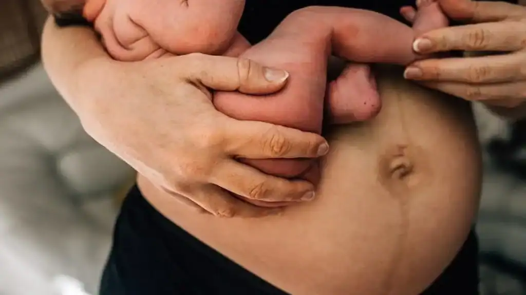 Why Is My Stomach Still Big After Pregnancy London?
